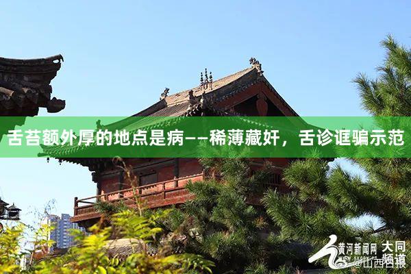 舌苔额外厚的地点是病——稀薄藏奸，舌诊诓骗示范